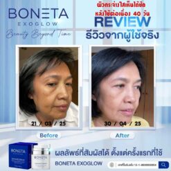 BONETA EXOGLOW รีวิว โบเนต้า ผิวสว่างกระจ่างใส ริ้วรอย ผิวชุ่มชื้น ฝ้า กระ ตีนกา