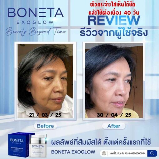 BONETA EXOGLOW รีวิว โบเนต้า ผิวสว่างกระจ่างใส ริ้วรอย ผิวชุ่มชื้น ฝ้า กระ ตีนกา