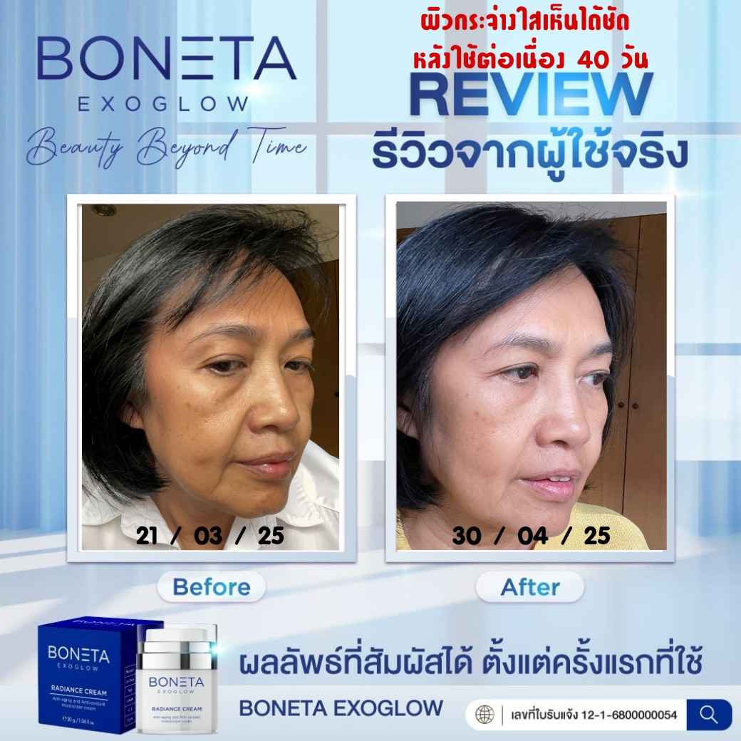 BONETA EXOGLOW รีวิว โบเนต้า ผิวสว่างกระจ่างใส ริ้วรอย ผิวชุ่มชื้น ฝ้า กระ ตีนกา