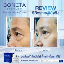 BONETA EXOGLOW รีวิว โบเนต้า ผิวสว่างกระจ่างใส ริ้วรอย ผิวชุ่มชื้น ฝ้า กระ ตีนกา