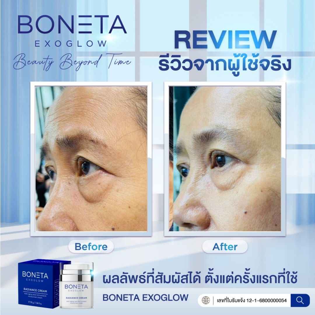 BONETA EXOGLOW รีวิว โบเนต้า ผิวสว่างกระจ่างใส ริ้วรอย ผิวชุ่มชื้น ฝ้า กระ ตีนกา
