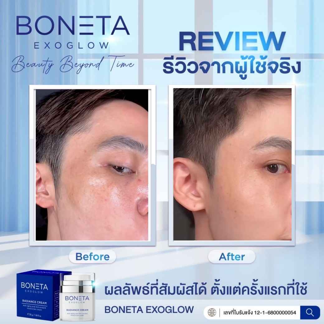 BONETA EXOGLOW รีวิว โบเนต้า ผิวสว่างกระจ่างใส ริ้วรอย ผิวชุ่มชื้น ฝ้า กระ ตีนกา