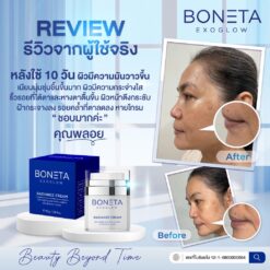BONETA EXOGLOW รีวิว โบเนต้า ผิวสว่างกระจ่างใส ริ้วรอย ผิวชุ่มชื้น ฝ้า กระ ตีนกา