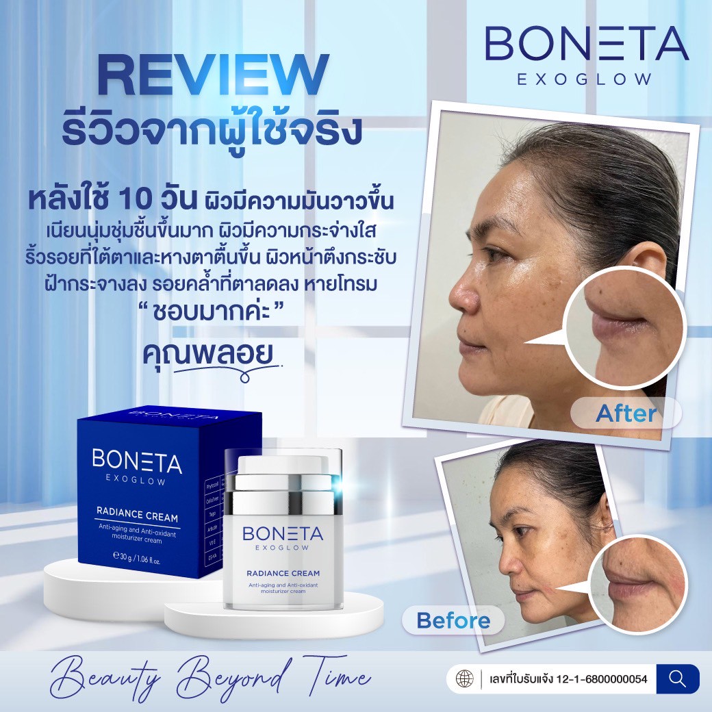 BONETA EXOGLOW รีวิว โบเนต้า ผิวสว่างกระจ่างใส ริ้วรอย ผิวชุ่มชื้น ฝ้า กระ ตีนกา
