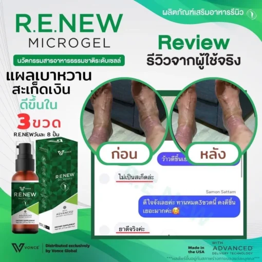 RENEW รีนิว ปวดข้อ ปวดเข่า โรคเก๊าท์ เบาหวาน ออฟฟิศซินโดรม กล้ามเนื้ออักเสบ สะเก็ดเงิน
