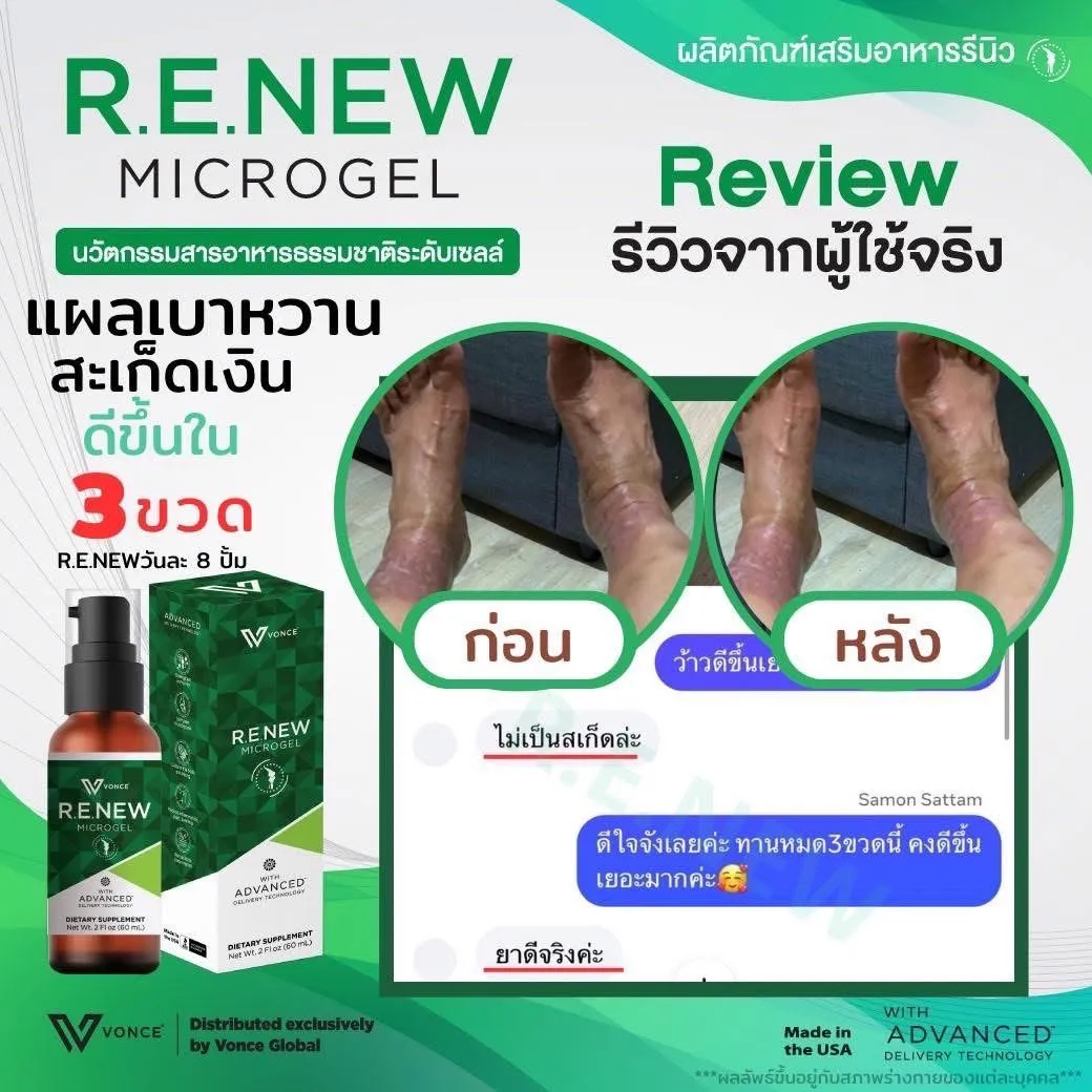 RENEW รีนิว ปวดข้อ ปวดเข่า โรคเก๊าท์ เบาหวาน ออฟฟิศซินโดรม กล้ามเนื้ออักเสบ สะเก็ดเงิน